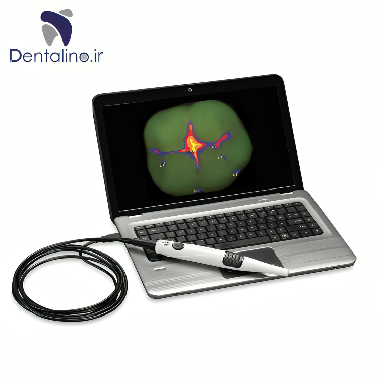 دستگاه تشخیص پوسیدگی Air Techniques