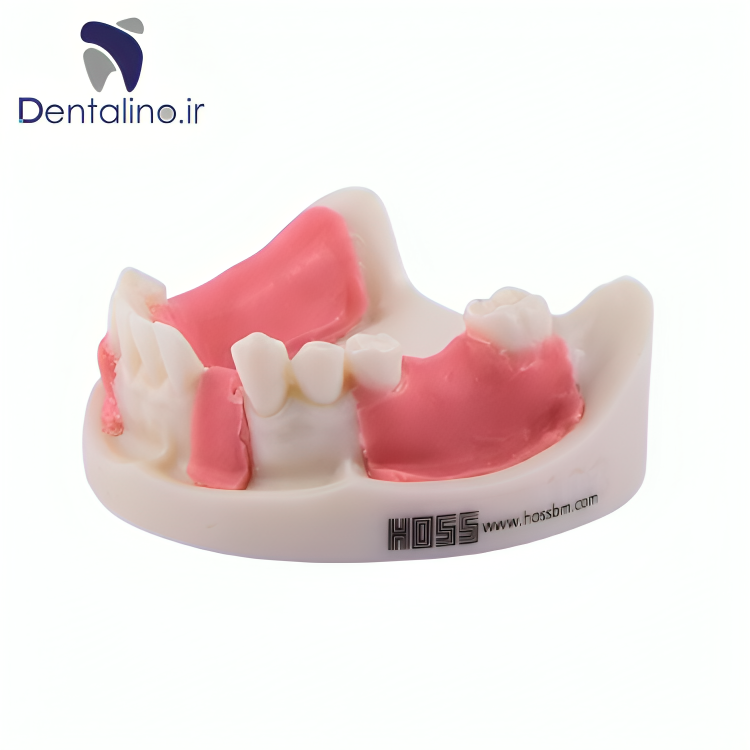 مدل تمرینی ایمپلنت فک پایین